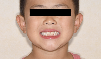 症例画像前からbefore