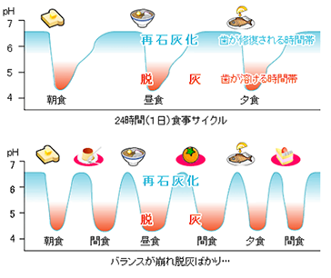 食生活・生活習慣の虫歯への影響