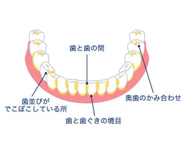 正しい歯磨きで歯茎も健康