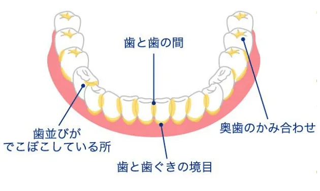 正しい歯磨きで歯茎も健康